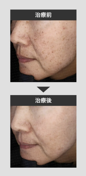 フォトの症例写真